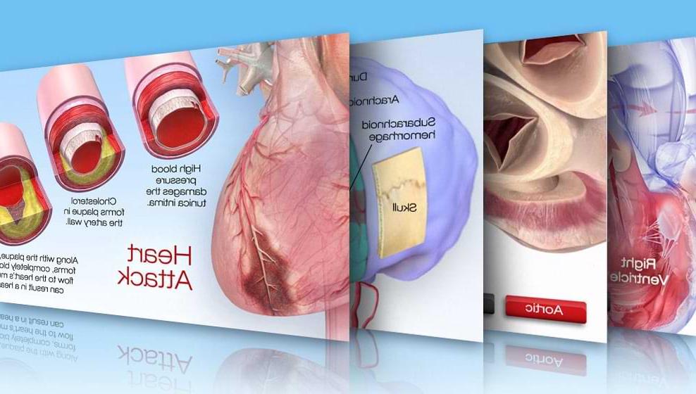 Interactive Cardiovascular Library Thumbnail image